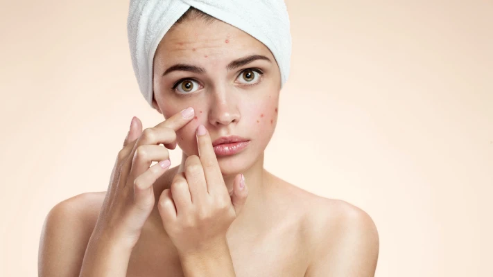 Skin Treatments in Regina for Acne and Blemish Control
